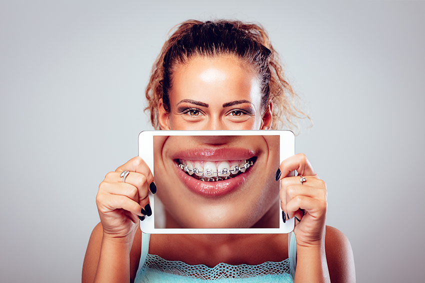 You Can Smile With Braces